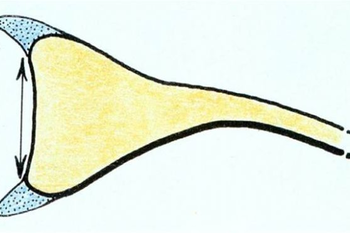 astatheia