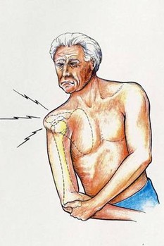 astatheia