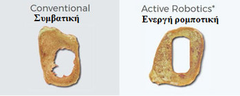 Κλινικά αποτελέσματα με το χειρουργικό σύστημα TSolution One®